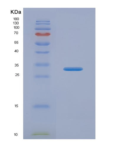 SDS-PAGE analysis of Human CACYBP (Calcyclin-Binding Protein) - Recombinant Protein, CAT# BLT-00384P, showing >95% purity under 15% SDS-PAGE (Reduced)Human CACYBP (Calcyclin-Binding Protein) - Recombinant Protein