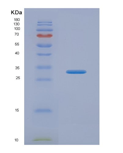 SDS-PAGE analysis of Human CACYBP (Calcyclin-Binding Protein) - Recombinant Protein, CATHuman CACYBP (Calcyclin-Binding Protein) - Recombinant Protein