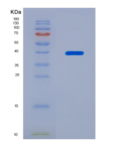 SDS-PAGE analysis of Human S100A14 (Protein S100-A14) - Recombinant Protein, CAT# BLT-02665P, showing >85% purity under 15% SDS-PAGE (Reduced)Human S100A14 (Protein S100-A14) - Recombinant Protein