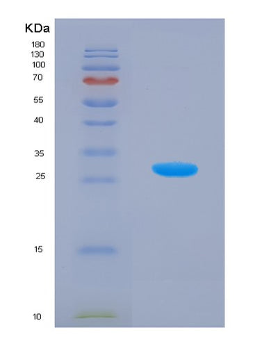 SDS-PAGE analysis of Human APMAP (Adipocyte Plasma Membrane-Associated Protein) - Recombinant Protein, CAT# BLT-00183P, showing >90% purity under 15% SDS-PAGE (Reduced)Human APMAP (Adipocyte Plasma Membrane-Associated Protein) - Recombinant Protein