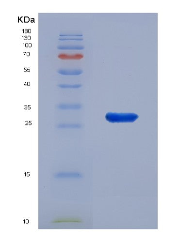 SDS-PAGE analysis of Human EXOSC4 (Exosome Complex Component Rrp41) - Recombinant Protein, CATHuman EXOSC4 (Exosome Complex Component Rrp41) - Recombinant Protein