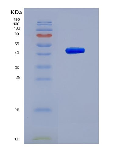 SDS-PAGE analysis of Human ACP6 (Lysophosphatidic Acid Phosphatase Type 6) - Recombinant Protein, CAT# BLT-00042P, showing >95% purity under 15% SDS-PAGE (Reduced)Human ACP6 (Lysophosphatidic Acid Phosphatase Type 6) - Recombinant Protein