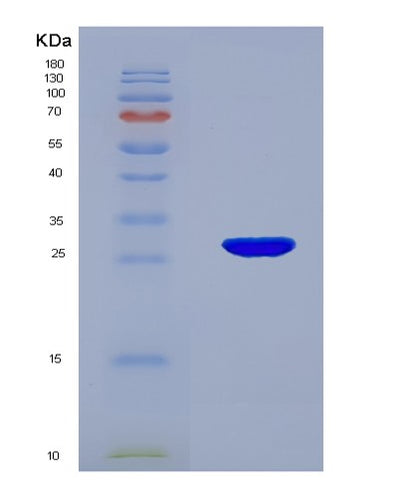 SDS-PAGE analysis of Human NRG1 (Pro-Neuregulin-1, Membrane-Bound Isoform) - Recombinant Protein, CAT# BLT-07777P, showing >90% purity under 15% SDS-PAGE (Reduced)Human NRG1 (Pro-Neuregulin-1, Membrane-Bound Isoform) - Recombinant Protein