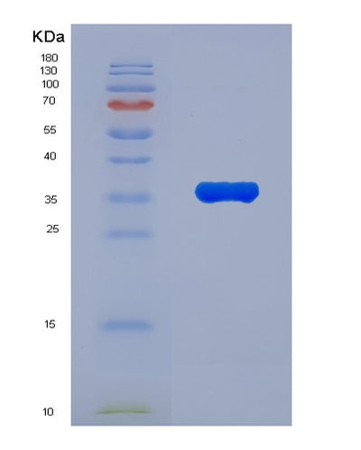 SDS-PAGE analysis of Human TIGAR (Fructose-2,6-Bisphosphatase Tigar) - Recombinant Protein, CAT# BLT-03043P, showing >85% purity under 15% SDS-PAGE (Reduced)Human TIGAR (Fructose-2,6-Bisphosphatase Tigar) - Recombinant Protein