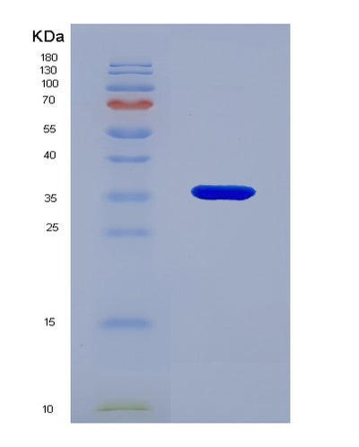 SDS-PAGE analysis of Human RTN4 (Reticulon-4) - Recombinant Protein, CAT# BLT-06111P, showing >85% purity under 15% SDS-PAGE (Reduced)Human RTN4 (Reticulon-4) - Recombinant Protein