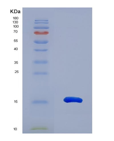 SDS-PAGE analysis of Human CCL28 (C-C Motif Chemokine 28) - Recombinant Protein, CAT# BLT-00448P, showing >95% purity under 15% SDS-PAGE (Reduced)Human CCL28 (C-C Motif Chemokine 28) - Recombinant Protein
