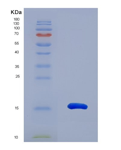 SDS-PAGE analysis of Human CCL28 (C-C Motif Chemokine 28) - Recombinant Protein, CATHuman CCL28 (C-C Motif Chemokine 28) - Recombinant Protein