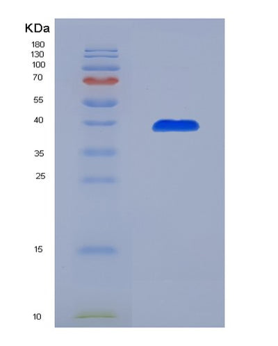 SDS-PAGE analysis of Human AASDHPPT (L-Aminoadipate-Semialdehyde Dehydrogenase-Phosphopantetheinyl Transferase) - Recombinant Protein, CAT# BLT-00015P, showing >85% purity under 15% SDS-PAGE (Reduced)Human AASDHPPT (L-Aminoadipate-Semialdehyde Dehydrogenase-Phosphopantetheinyl Transferase) - Recombinant Protein