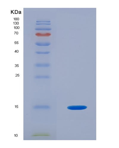 SDS-PAGE analysis of Human PHPT1 (14 Kda Phosphohistidine Phosphatase) - Recombinant Protein, CAT# BLT-02258P, showing >95% purity under 15% SDS-PAGE (Reduced)Human PHPT1 (14 Kda Phosphohistidine Phosphatase) - Recombinant Protein