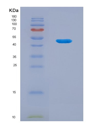 SDS-PAGE analysis of Human GKN1 (Gastrokine-1) - Recombinant Protein, CATHuman GKN1 (Gastrokine-1) - Recombinant Protein