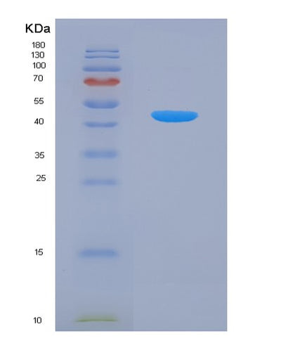 SDS-PAGE analysis of Human CHI3L1 (Chitinase-3-Like Protein 1) - Recombinant Protein, CAT# BLT-07778P, showing >90% purity under 15% SDS-PAGE (Reduced)Human CHI3L1 (Chitinase-3-Like Protein 1) - Recombinant Protein