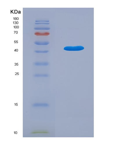 SDS-PAGE analysis of Human TBC1D13 (Tbc1 Domain Family Member 13) - Recombinant Protein, CAT# BLT-02982P, showing >85% purity under 15% SDS-PAGE (Reduced)Human TBC1D13 (Tbc1 Domain Family Member 13) - Recombinant Protein