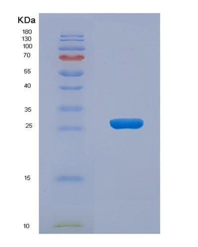 SDS-PAGE analysis of Human ARL15 (Adp-Ribosylation Factor-Like Protein 15) - Recombinant Protein, CAT# BLT-00212P, showing >90% purity under 15% SDS-PAGE (Reduced)Human ARL15 (Adp-Ribosylation Factor-Like Protein 15) - Recombinant Protein