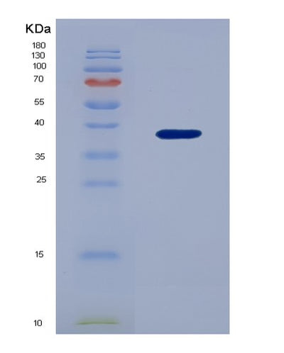 SDS-PAGE analysis of Human UBAP1 (Ubiquitin-Associated Protein 1) - Recombinant Protein, CAT# BLT-04643P, showing >85% purity under 15% SDS-PAGE (Reduced)Human UBAP1 (Ubiquitin-Associated Protein 1) - Recombinant Protein