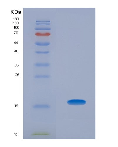 SDS-PAGE analysis of Human AHSP (Alpha-Hemoglobin-Stabilizing Protein) - Recombinant Protein, CATHuman AHSP (Alpha-Hemoglobin-Stabilizing Protein) - Recombinant Protein