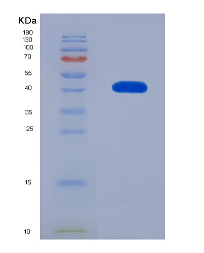 SDS-PAGE analysis of Human MAT2B (Methionine Adenosyltransferase 2 Subunit Beta) - Recombinant Protein, CATHuman MAT2B (Methionine Adenosyltransferase 2 Subunit Beta) - Recombinant Protein