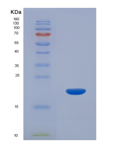 SDS-PAGE analysis of Human CALML5 (Calmodulin-Like Protein 5) - Recombinant Protein, CAT# BLT-05187P, showing >90% purity under 15% SDS-PAGE (Reduced)Human CALML5 (Calmodulin-Like Protein 5) - Recombinant Protein