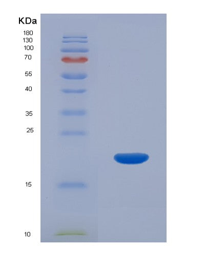 SDS-PAGE analysis of Human CALML5 (Calmodulin-Like Protein 5) - Recombinant Protein, CATHuman CALML5 (Calmodulin-Like Protein 5) - Recombinant Protein