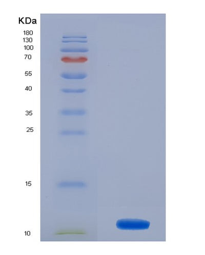 SDS-PAGE analysis of Human MSRB1 (Methionine-R-Sulfoxide Reductase B1) - Recombinant Protein, CAT# BLT-02736P, showing >85% purity under 15% SDS-PAGE (Reduced)Human MSRB1 (Methionine-R-Sulfoxide Reductase B1) - Recombinant Protein