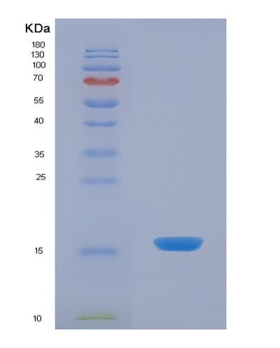 SDS-PAGE analysis of Human VAPA (Vesicle-Associated Membrane Protein-Associated Protein A) - Recombinant Protein, CAT# BLT-03269P, showing >85% purity under 15% SDS-PAGE (Reduced)Human VAPA (Vesicle-Associated Membrane Protein-Associated Protein A) - Recombinant Protein
