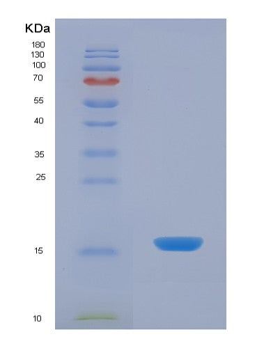 SDS-PAGE analysis of Human VAPA (Vesicle-Associated Membrane Protein-Associated Protein A) - Recombinant Protein, CATHuman VAPA (Vesicle-Associated Membrane Protein-Associated Protein A) - Recombinant Protein