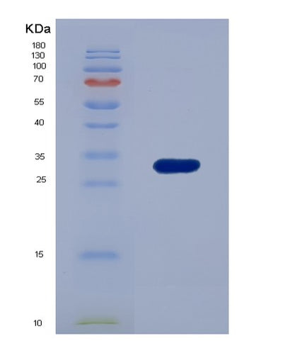 SDS-PAGE analysis of Human SIRPG (Signal-Regulatory Protein Gamma) - Recombinant Protein, CAT# BLT-02784P, showing >85% purity under 15% SDS-PAGE (Reduced)Human SIRPG (Signal-Regulatory Protein Gamma) - Recombinant Protein