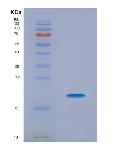 SDS-PAGE analysis of Mouse Pin1 (Peptidyl-Prolyl Cis-Trans Isomerase Nima-Interacting 1) - Recombinant Protein, CAT# BLT-02268P, showing >85% purity under 15% SDS-PAGE (Reduced)Mouse Pin1 (Peptidyl-Prolyl Cis-Trans Isomerase Nima-Interacting 1) - Recombinant Protein