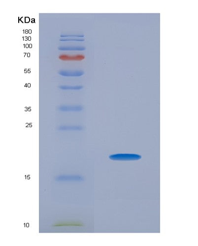 SDS-PAGE analysis of Mouse Pin1 (Peptidyl-Prolyl Cis-Trans Isomerase Nima-Interacting 1) - Recombinant Protein, CATMouse Pin1 (Peptidyl-Prolyl Cis-Trans Isomerase Nima-Interacting 1) - Recombinant Protein
