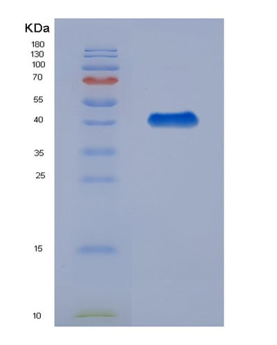 SDS-PAGE analysis of Human C3 (Complement C3) - Recombinant Protein, CAT# BLT-07779P, showing >90% purity under 15% SDS-PAGE (Reduced)Human C3 (Complement C3) - Recombinant Protein