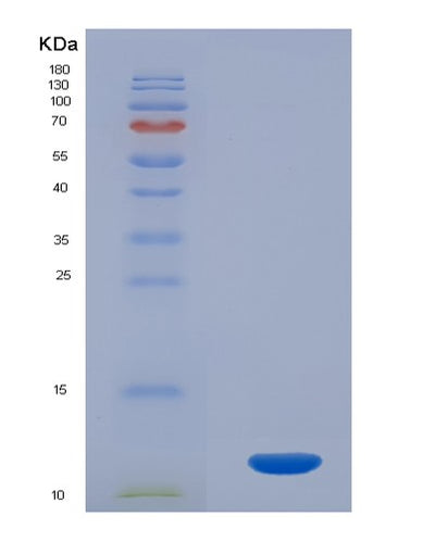 SDS-PAGE analysis of Human CLCF1 (Cardiotrophin-Like Cytokine Factor 1) - Recombinant Protein, CAT# BLT-00618P, showing >90% purity under 15% SDS-PAGE (Reduced)Human CLCF1 (Cardiotrophin-Like Cytokine Factor 1) - Recombinant Protein