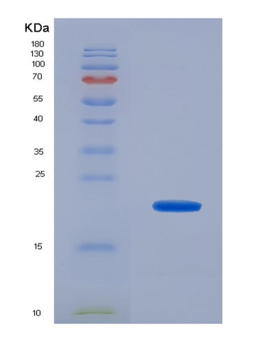 SDS-PAGE analysis of Human UXT (Protein Uxt) - Recombinant Protein, CAT# BLT-03263P, showing >85% purity under 15% SDS-PAGE (Reduced)Human UXT (Protein Uxt) - Recombinant Protein