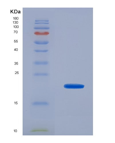 SDS-PAGE analysis of Human UXT (Protein Uxt) - Recombinant Protein, CATHuman UXT (Protein Uxt) - Recombinant Protein