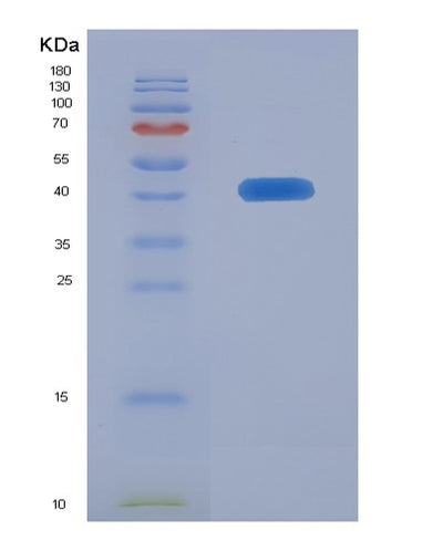 SDS-PAGE analysis of Human CGA (Glycoprotein Hormones Alpha Chain) - Recombinant Protein, CAT# BLT-07781P, showing >90% purity under 15% SDS-PAGE (Reduced)Human CGA (Glycoprotein Hormones Alpha Chain) - Recombinant Protein