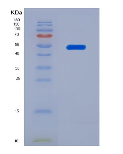 SDS-PAGE analysis of Human CHRNA9 (Neuronal Acetylcholine Receptor Subunit Alpha-9) - Recombinant Protein, CAT# BLT-07782P, showing >90% purity under 15% SDS-PAGE (Reduced)Human CHRNA9 (Neuronal Acetylcholine Receptor Subunit Alpha-9) - Recombinant Protein
