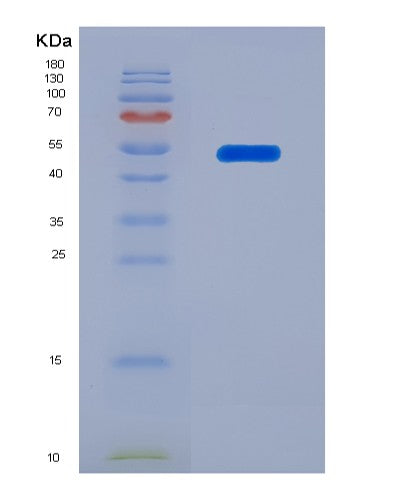 SDS-PAGE analysis of Human CHRNA9 (Neuronal Acetylcholine Receptor Subunit Alpha-9) - Recombinant Protein, CATHuman CHRNA9 (Neuronal Acetylcholine Receptor Subunit Alpha-9) - Recombinant Protein