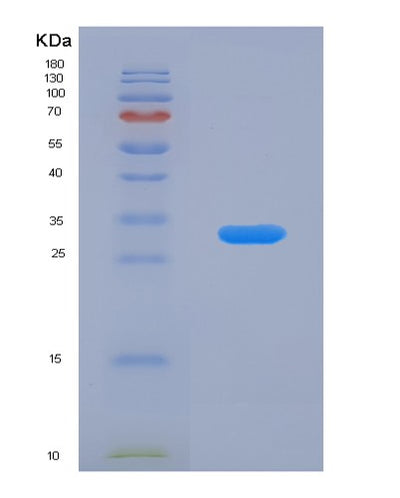 SDS-PAGE analysis of Human PCDHB6 (Protocadherin Beta-6) - Recombinant Protein, CAT# BLT-07783P, showing >90% purity under 15% SDS-PAGE (Reduced)Human PCDHB6 (Protocadherin Beta-6) - Recombinant Protein