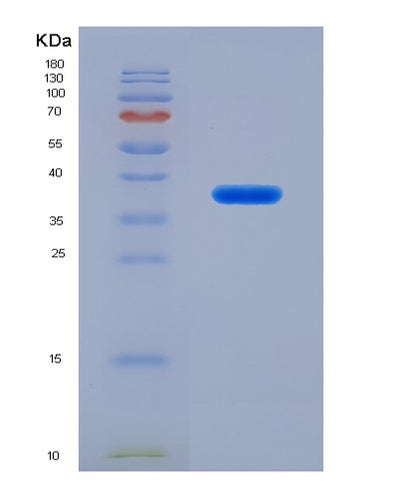 SDS-PAGE analysis of Human CTSZ (Cathepsin Z) - Recombinant Protein, CAT# BLT-00763P, showing >95% purity under 15% SDS-PAGE (Reduced)Human CTSZ (Cathepsin Z) - Recombinant Protein