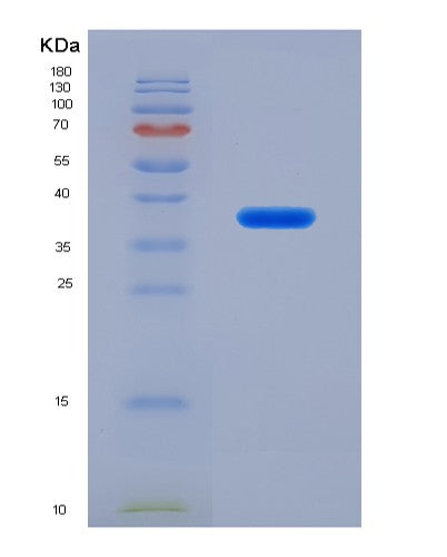 SDS-PAGE analysis of Human CTSZ (Cathepsin Z) - Recombinant Protein, CATHuman CTSZ (Cathepsin Z) - Recombinant Protein