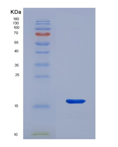 SDS-PAGE analysis of Human LAMTOR3 (Ragulator Complex Protein Lamtor3) - Recombinant Protein, CAT# BLT-04902P, showing >95% purity under 15% SDS-PAGE (Reduced)Human LAMTOR3 (Ragulator Complex Protein Lamtor3) - Recombinant Protein