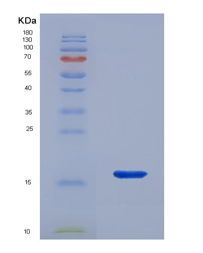 SDS-PAGE analysis of Human LAMTOR3 (Ragulator Complex Protein Lamtor3) - Recombinant Protein, CATHuman LAMTOR3 (Ragulator Complex Protein Lamtor3) - Recombinant Protein