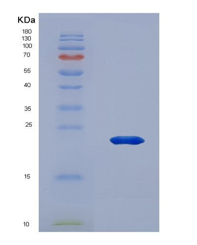 SDS-PAGE analysis of Human IL36A (Interleukin-36 Alpha) - Recombinant Protein, CATHuman IL36A (Interleukin-36 Alpha) - Recombinant Protein