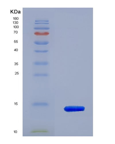 SDS-PAGE analysis of Human UBQLN2 (Ubiquilin-2) - Recombinant Protein, CAT# BLT-03222P, showing >90% purity under 15% SDS-PAGE (Reduced)Human UBQLN2 (Ubiquilin-2) - Recombinant Protein