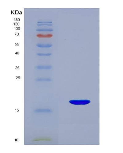 SDS-PAGE analysis of Human TAC3 (Tachykinin-3) - Recombinant Protein, CAT# BLT-02017P, showing >90% purity under 15% SDS-PAGE (Reduced)Human TAC3 (Tachykinin-3) - Recombinant Protein