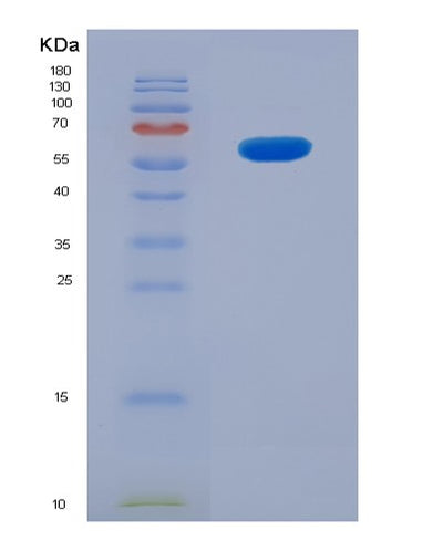 SDS-PAGE analysis of Human CD207 (C-Type Lectin Domain Family 4 Member K) - Recombinant Protein, CAT# BLT-00474P, showing >85% purity under 15% SDS-PAGE (Reduced)Human CD207 (C-Type Lectin Domain Family 4 Member K) - Recombinant Protein