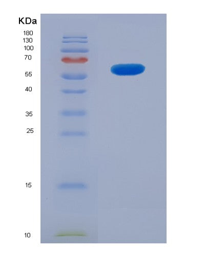 SDS-PAGE analysis of Human CD207 (C-Type Lectin Domain Family 4 Member K) - Recombinant Protein, CATHuman CD207 (C-Type Lectin Domain Family 4 Member K) - Recombinant Protein