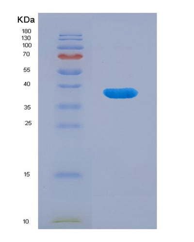 SDS-PAGE analysis of Human ANXA10 (Annexin A10) - Recombinant Protein, CAT# BLT-00171P, showing >90% purity under 15% SDS-PAGE (Reduced)Human ANXA10 (Annexin A10) - Recombinant Protein