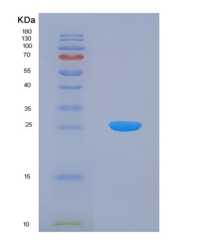 SDS-PAGE analysis of Human HSPB8 (Heat Shock Protein Beta-8) - Recombinant Protein, CAT# BLT-01452P, showing >90% purity under 15% SDS-PAGE (Reduced)Human HSPB8 (Heat Shock Protein Beta-8) - Recombinant Protein
