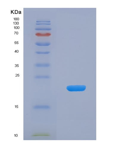 SDS-PAGE analysis of Human EGR1 (Early Growth Response Protein 1) - Recombinant Protein, CAT# BLT-04727P, showing >85% purity under 15% SDS-PAGE (Reduced)Human EGR1 (Early Growth Response Protein 1) - Recombinant Protein