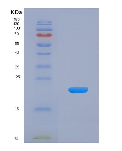 SDS-PAGE analysis of Human EGR1 (Early Growth Response Protein 1) - Recombinant Protein, CATHuman EGR1 (Early Growth Response Protein 1) - Recombinant Protein