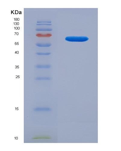 SDS-PAGE analysis of Human FBXO2 (F-Box Only Protein 2) - Recombinant Protein, CATHuman FBXO2 (F-Box Only Protein 2) - Recombinant Protein